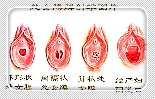 当宫口开到多大时可以进入产房?